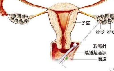 2026临江市最新男性陪产假有多少天？试管婴儿可以增加产假吗？