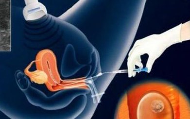 2026合肥第三代试管婴儿费用清单，其依据可靠性如何？