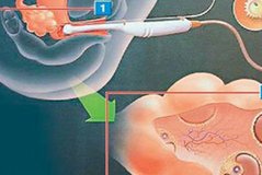 2026年广东地区优质助孕机构推荐：哪家助孕公司更值得信赖？（权威助孕机构名单揭晓）